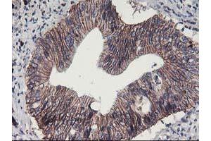 Image no. 1 for anti-Arachidonate 15-Lipoxygenase (ALOX15) antibody (ABIN1496359)