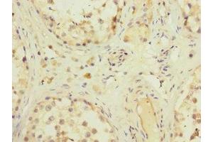 Immunohistochemistry of paraffin-embedded human testis tissue using ABIN7176632 at dilution of 1:100 (ZFPM2 anticorps  (AA 982-1151))