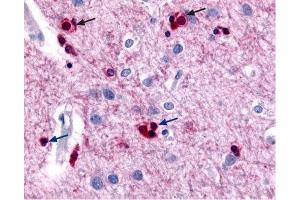 Expression of KCNN2 (SK2) in rat cerebral cortex - Immunohistochemical staining of KCNN2 channels using Anti-KCNN2 (KCa2.