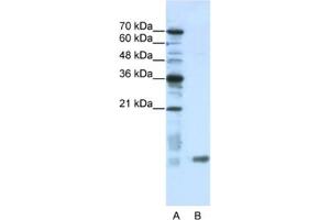 Western Blotting (WB) image for anti-SRA Stem-Loop Interacting RNA Binding Protein (SLIRP) antibody (ABIN2462309)