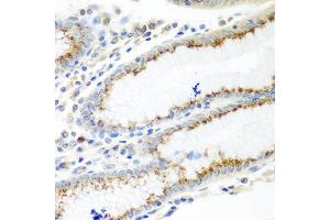 Immunohistochemistry of paraffin-embedded human stomach using UBIAD1 antibody at dilution of 1:100 (40x lens). (UBIAD1 anticorps)