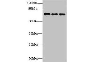 Western blot All lanes: ZNF614 antibody at 6 μg/mL Lane 1: Jurkat whole cell lysate Lane 2: HepG2 whole cell lysate Lane 3: A549 whole cell lysate Secondary Goat polyclonal to rabbit IgG at 1/10000 dilution Predicted band size: 68, 23 kDa Observed band size: 68 kDa (ZNF614 anticorps  (AA 1-198))