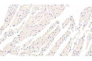 Detection of TMOD3 in Mouse Cardiac Muscle Tissue using Polyclonal Antibody to Tropomodulin 3 (TMOD3)