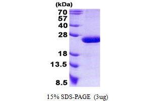 Image no. 1 for RAP2B, Member of RAS Oncogene Family (RAP2B) protein (His tag) (ABIN1098540)