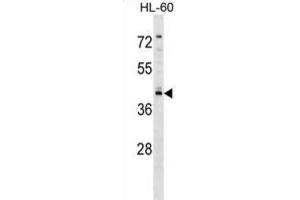 Western Blotting (WB) image for anti-Regulator of G-Protein Signaling 11 (RGS11) antibody (ABIN2999155) (RGS11 anticorps)