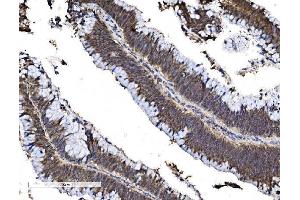 IHC analysis of FOXA2 using anti-FOXA2 antibody (ABIN7600003). (FOXA2 anticorps  (AA 139-446))