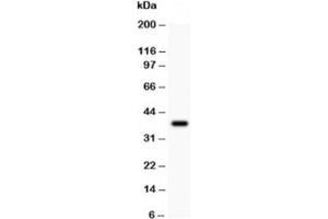Western blot testing of NALP3 antibody and recombinant human protein (0.