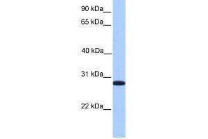 WB Suggested Anti-CDKN3 Antibody Titration: 0. (CDKN3 anticorps  (C-Term))