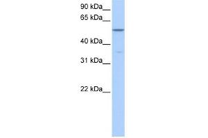 CHKA antibody used at 1 ug/ml to detect target protein.