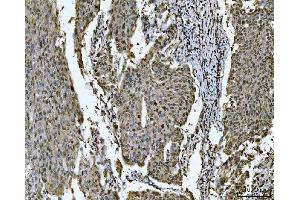 IHC analysis of SNRPN using anti-SNRPN antibody (ABIN3043934). (SNRPN anticorps  (N-Term))