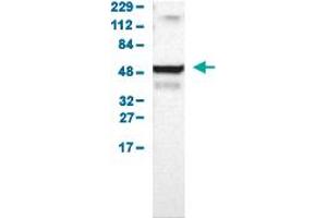 Western Blot analysis of human cell line RT-4. (UCKL1 anticorps  (AA 86-203))