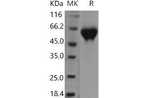 Western Blotting (WB) image for Interleukin 1 Receptor, Type II (IL1R2) (Active) protein (His tag) (ABIN7196348)