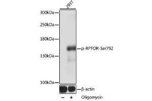 Western blot analysis of extracts of 293T cells using Phospho-RPTOR(Ser792) Polyclonal Antibody at dilution of 1:1000. (Raptor anticorps  (pSer792))