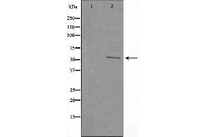 Western blot analysis of extracts from A549 cells using RAD23B antibody. (RAD23B anticorps  (N-Term))