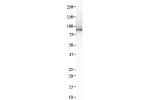 Host:  Rabbit  Target Name:  ITGB8  Sample Type:  Human Kidney  Antibody Dilution:  1.