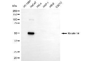 Western blotting analysis using keratin 14 antibody (ABIN7799168).