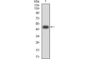 Western blot analysis using CD161 mAb against human CD161 (AA: extra 67-225) recombinant protein. (CD161 anticorps  (AA 67-225))