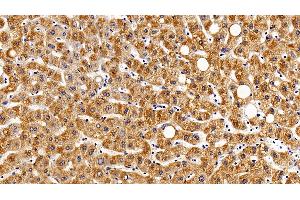 Detection of gp130 in Human Liver Tissue using Polyclonal Antibody to Glycoprotein 130 (gp130) (CD130/gp130 anticorps  (AA 392-566))
