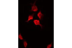 ABIN6267501 staining HeLa by IF/ICC. (p21 anticorps  (pThr145))