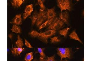 Immunofluorescence analysis of C6 cells using ATP1B1 Polyclonal Antibody at dilution of 1:100. (ATP1B1 anticorps)