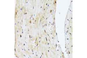 Immunohistochemistry of paraffin-embedded mouse heart using PSMD14 Rabbit mAb (ABIN7269588) at dilution of 1:100 (40x lens).