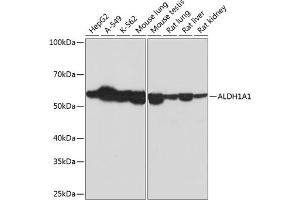 Western blot analysis of extracts of various cell lines, using  Rabbit mAb (ABIN7265531) at 1:1000 dilution. (ALDH1A1 anticorps)