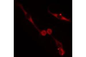 ABIN6272622 staining HepG2 cells by IF/ICC. (NRBP1 anticorps  (Internal Region))