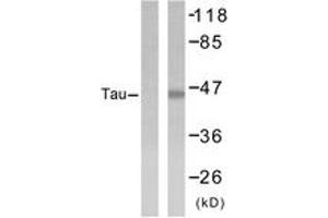 Western blot analysis of extracts from 293 cells, treated with UV, using Tau (Ab-404) Antibody. (tau anticorps  (AA 691-740))