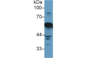 Detection of VIM in Rat Heart lysate using Monoclonal Antibody to Vimentin (VIM)