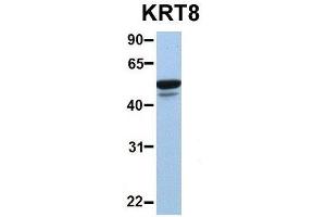Host:  Rabbit  Target Name:  KRT8  Sample Type:  Human MCF7  Antibody Dilution:  1.