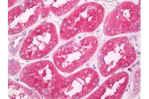 Anti-GNPDA1 antibody IHC of human kidney.