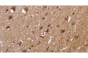 Immunohistochemistry of paraffin-embedded Human brain tissue using EXTL3 Polyclonal Antibody at dilution 1:30 (EXTL3 anticorps)