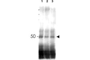 Western blot using MER2 polyclonal antibody  shows detection of phosphorylated and unphosphorylated MER2 in wild type, phosphatase treated and mutant cells. (CD151 anticorps  (AA 26-35))