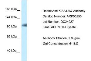 Western Blotting (WB) image for anti-KAT8 Regulatory NSL Complex Subunit 1 (KANSL1) (N-Term) antibody (ABIN970994) (KANSL1 anticorps  (N-Term))