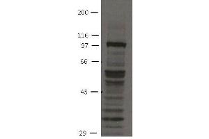 Image no. 1 for anti-Fibroblast Growth Factor Receptor 4 (FGFR4) (Cytoplasmic Domain) antibody (ABIN1169685) (FGFR4 anticorps  (Cytoplasmic Domain))