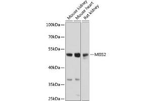 Western blot analysis of extracts of various cell lines, using MEIS2 antibody (ABIN6128272, ABIN6143723, ABIN6143724 and ABIN6224498) at 1:1000 dilution. (MEIS2 anticorps  (AA 351-470))