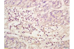 Formalin-fixed and paraffin embedded human liver labeled with Anti-phospho-ERK1/2(Thr202 + Tyr204) Polyclonal Antibody, Unconjugated (ABIN682933) at 1:200 followed by conjugation to the secondary antibody and DAB staining (ERK1/2 anticorps  (pThr202, pTyr204))