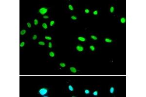 Immunofluorescence analysis of A549 cells using RUVBL1 Polyclonal Antibody (RUVBL1 anticorps)