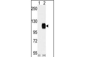 Western blot analysis of SKY (arrow) using rabbit polyclonal SKY Antibody (C-term) (ABIN392054 and ABIN2841821). (TYRO3 anticorps  (C-Term))