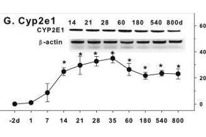 Age-related expression of CYP-2 family gene/proteins in livers of male rats. (CYP2E1 anticorps  (AA 401-493))