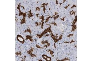 Immunohistochemical staining of human pancreas with EXOC2 polyclonal antibody  shows strong cytoplasmic and membranous positivity in intercalated ducts at 1:2500-1:5000 dilution. (EXOC2 anticorps)