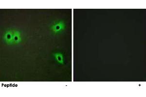 Immunofluorescence analysis of A-549 cells, using COL13A1 polyclonal antibody . (COL13A1 anticorps)