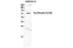 Western Blotting (WB) image for anti-FYN Oncogene Related To SRC, FGR, YES (FYN) (pTyr530) antibody (ABIN3182518) (FYN anticorps  (pTyr530))