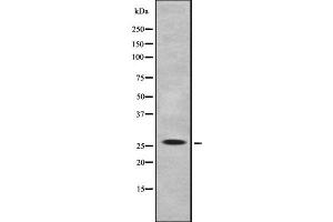 Western blot analysis IL-32 using K562 whole cell lysates (IL32 anticorps)