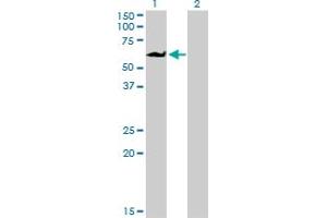 Western Blot analysis of EIF4G3 expression in transfected 293T cell line by EIF4G3 monoclonal antibody (M03), clone 1H5. (EIF4G3 anticorps  (AA 1-515))