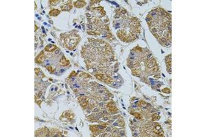 Immunohistochemistry of paraffin-embedded human stomach using TEFM antibody. (TEFM anticorps  (AA 36-210))