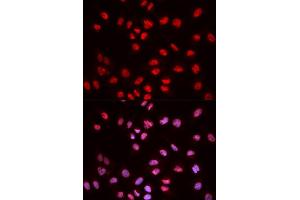 Immunofluorescence analysis of MCF-7 cells using Phospho-ELK1-S383 antibody (ABIN5969890). (ELK1 anticorps  (pSer383))