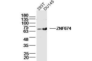 Lane 1: 293T lysates Lane 2: DU145 lysates probed with ZNF674 Polyclonal Antibody, Unconjugated  at 1:300 dilution and 4˚C overnight incubation. (ZNF674 anticorps  (AA 301-400))