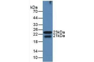 Detection of recombinant GAL8 using Polyclonal Antibody to Galectin 8 (GAL8) (LGALS8 anticorps  (AA 151-316))