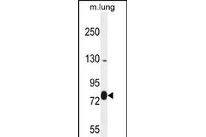EXOC8 Antibody (Center) (ABIN654161 and ABIN2844025) western blot analysis in mouse lung tissue lysates (35 μg/lane). (EXOC8 anticorps  (AA 360-389))